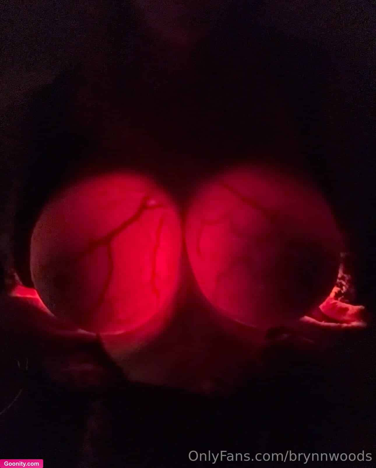 Brynn Woods photo 76