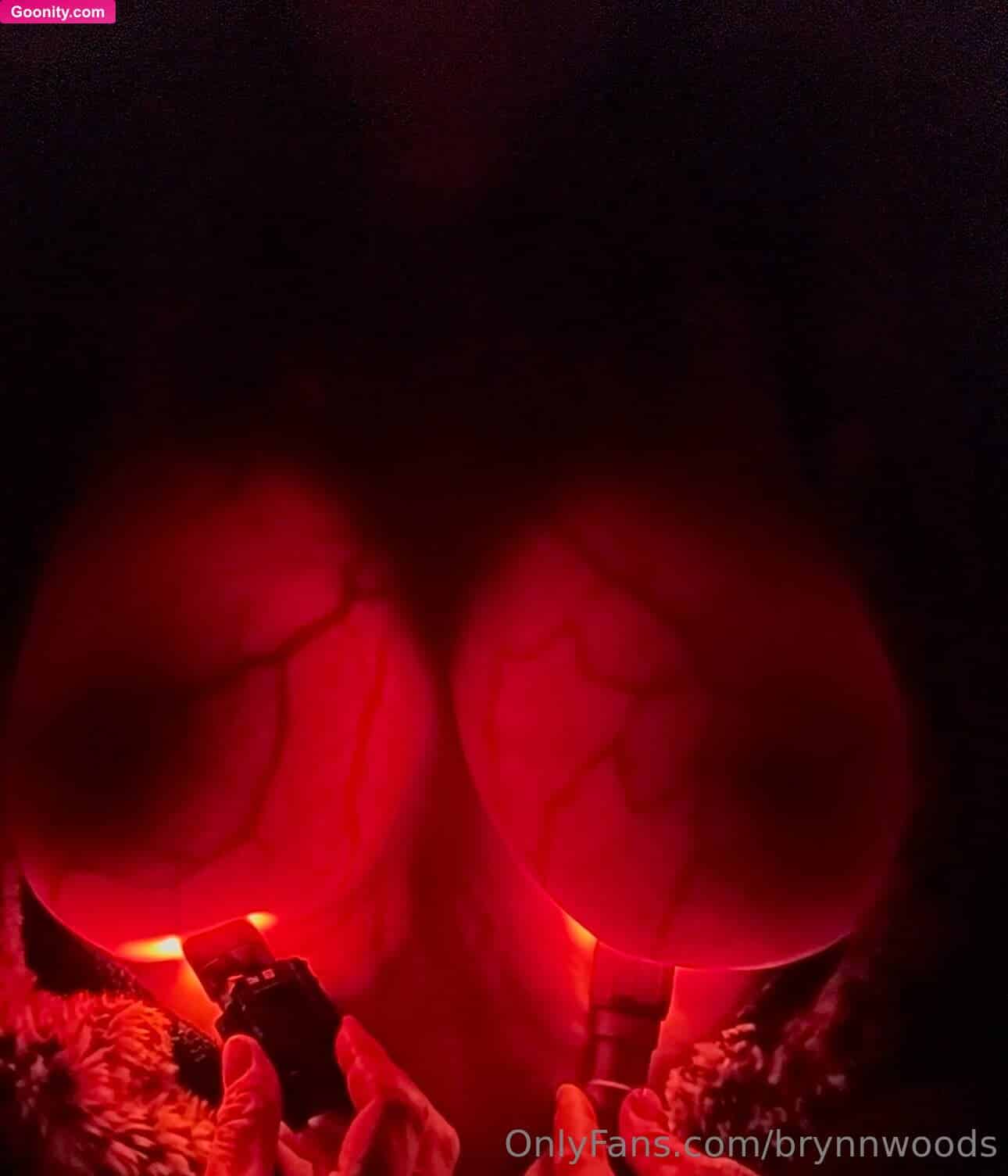 Brynn Woods photo 78